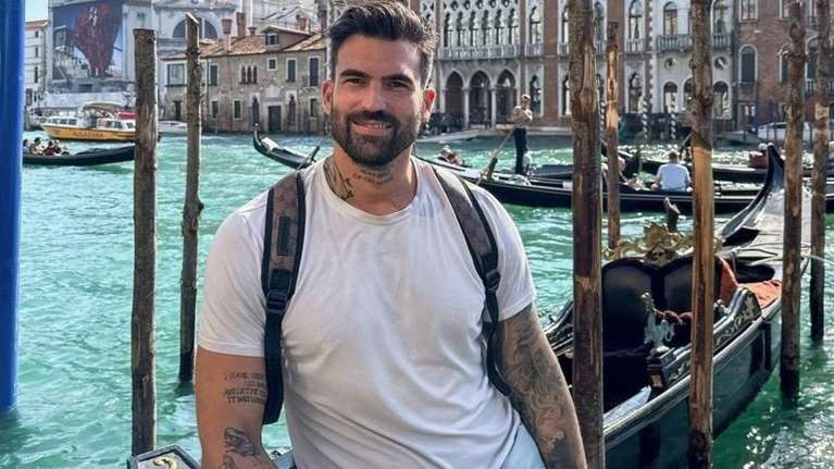 Ο Δημήτρης Αλεξάνδρου αφαίρεσε το τατουάζ που είχε κάνει για την Ιωάννα Τούνη