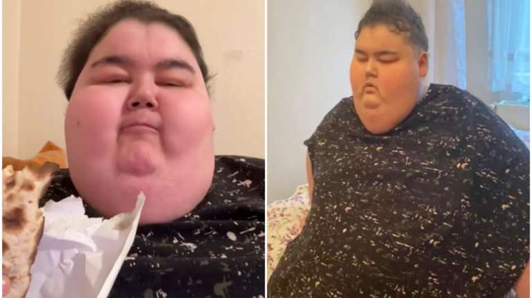 Τουρκία: Πέθανε από επιπλοκές της παχυσαρκίας 24χρονος TikToker - Έγινε διάσημος τρώγοντας τεράστιες ποσότητες φαγητού