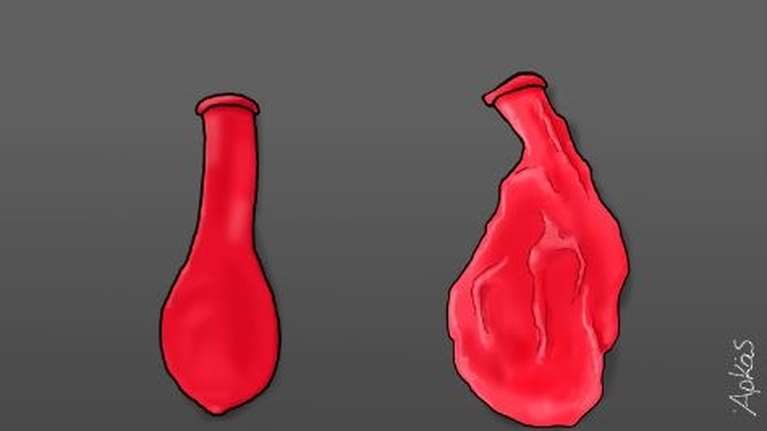 Αρκάς: Το νέο σκίτσο... "μπηχτή" για τα μπαλόνια που ξεφουσκώνουν