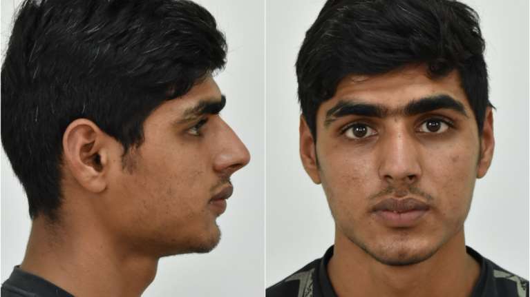 Φρίκη στο Κορωπί: Αυτός είναι ο 20χρονος που ασέλγησε σε 5χρονο κοριτσάκι [Εικόνες]