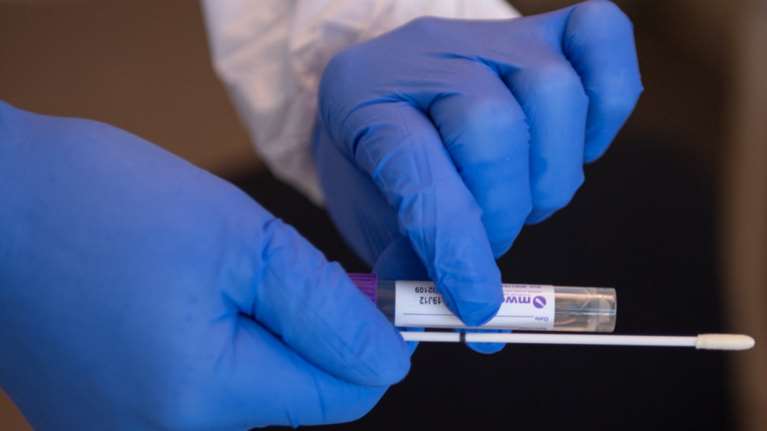 Κορονοϊός - Τσιόδρας: Γιατί δεν είναι τώρα η ώρα για μαζικά τεστ αντισωμάτων