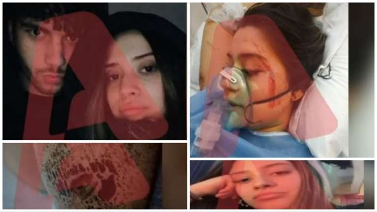 Τέμπη: "Ο κόσμος καιγόταν, έπεφτε από τα βαγόνια" - Η ανατριχιαστική περιγραφή της 19χρονης Βασιλικής που σώθηκε