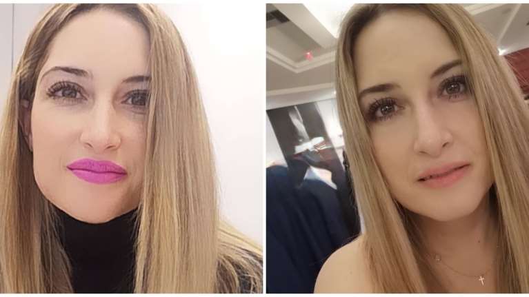 Παλιοσπύρου: Η συγκλονιστική ανάρτηση για το πώς ήταν πριν την επίθεση με βιτριόλι - "Κόντεψα να πεθάνω για το τίποτα"