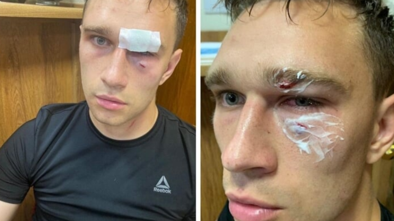 Ξυλοδαρμός &quot;σοκ&quot; από πρώην διεθνή ποδοσφαιριστή σε διαιτητή [Βίντεο]