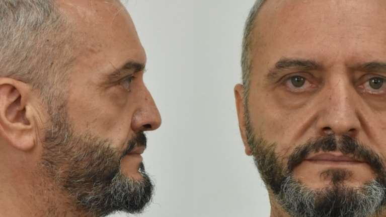 Κολωνός: Τι δεν αναμένεται να πει ο Ηλίας Μίχος στη συμπληρωματική απολογία του σήμερα