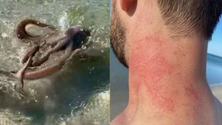 Αυστραλία: Τουρίστας δέχεται επίθεση από &quot;θυμωμένο χταπόδι&quot; και γίνεται viral [Βίντεο]