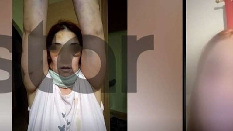 Άργος: "Μου είπε θα φτύσεις αίμα, με χτυπούσε με το σίδερο στο πρόσωπο" - Η συγκλονιστική περιγραφή της 32χρονης