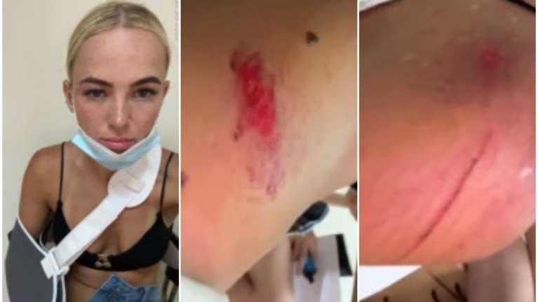 Κέρκυρα: &quot;Νόμιζα ότι θα πέθαινα&quot; – Βρετανίδα περιγράφει τις τρομακτικές στιγμές μετά το τροχαίο με γουρούνα [βίντεο]