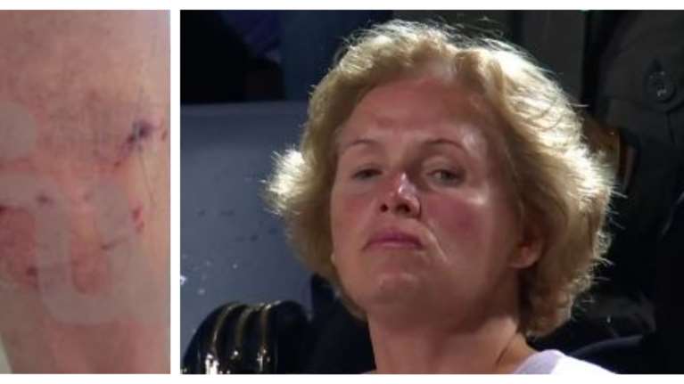 Ψάχνουν τη μητέρα του Τσιτσιπά για αυτόφωρο, μετά την επίθεση του σκύλου της σε 71χρονο - &quot;Εβρισε τον ηλικωμένο και έφυγε&quot;