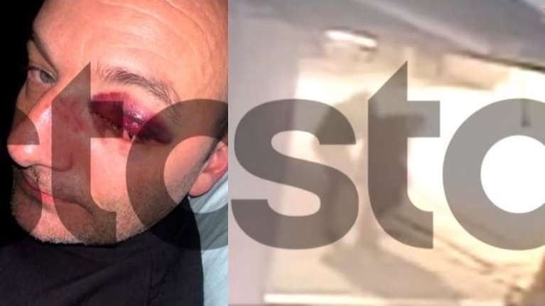 Τρίκαλα: Ανήλικοι ξυλοκόπησαν άγρια δικηγόρο επειδή... νόμιζαν ότι τους στραβοκοίταξε - Βίντεο ντοκουμέντο