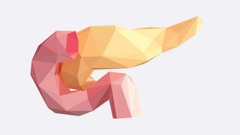 Τι είναι η οξεία παγκρεατίτιδα, τι την προκαλεί και η θεραπεία