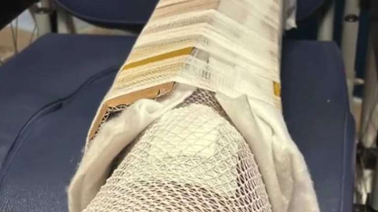 Εγινε και αυτό: Δεν είχαν γύψο και έδεσαν το πόδι 30χρονου σε χάρτινο κουτί σε νοσοκομείο στη Σικελία