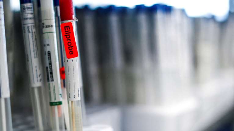 Κορονοϊός: Ποιο γονίδιο διπλασιάζει τον κίνδυνο σοβαρής νόσου - Τι ανακάλυψαν οι επιστήμονες