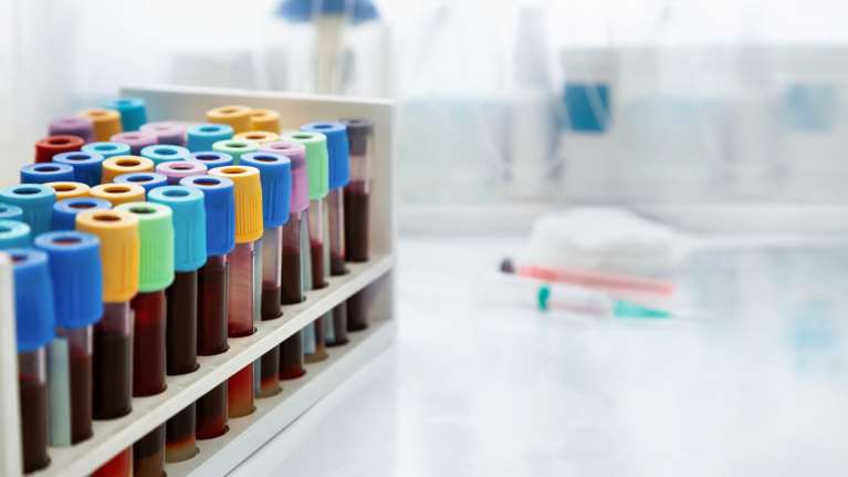 Ακόμη και σε καθημερινή βάση οι αιματολογικές εξετάσεις για τους ογκολογικούς ασθενείς- Διορθώθηκε η παλαιότερη οδηγία