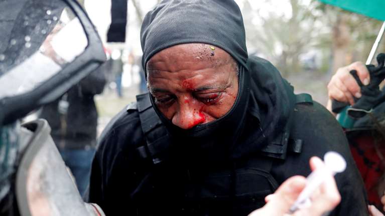 ΗΠΑ- Συγκλονιστικές φωτό: Oπαδoί του Τραμπ επιτίθενται και κακοποιούν αφροαμερικανούς ακτιβιστές [εικόνες]