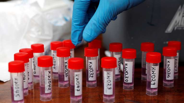 Κορονοϊός - έρευνα: Γιατί ξαναβγαίνουν θετικοί όσοι έχουν αναρρώσει - Σφάλμα στα μοριακά τεστ;