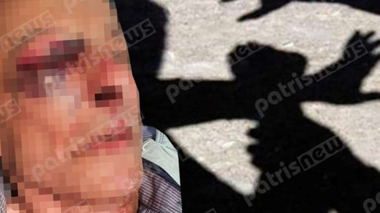 Ανδραβίδα: Άγριος ξυλοδαρμός 77χρονου από ομάδα ληστών