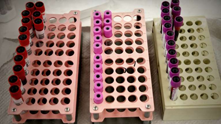 Κορονοιός: Οξεία μείωση των αποθεμάτων αίματος - Ξεκινούν υπαίθριες αιμοδοσίες