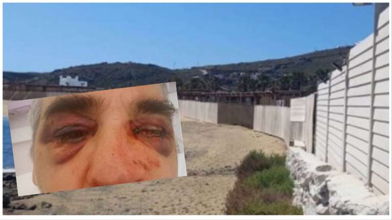 Μύκονος: Παρέμβαση Ντογιάκου για το όργιο οικοδοµικών αυθαιρεσιών - Ζητά κατ΄ απόλυτη προτεραιότητα εισαγγελική έρευνα