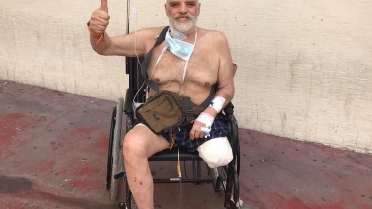 Συγκλονιστικό μήνυμα από τον ηθοποιό Γιώργο Βούρο μετά τον ακρωτηριασμό του ποδιού του - "Έπρεπε να φύγει..."