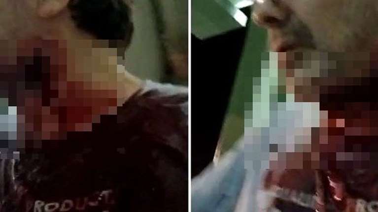 Στέφανος Χίος: Πού στρέφονται οι έρευνες της ΕΛ.ΑΣ για τους επίδοξους δολοφόνους του δημοσιογράφου