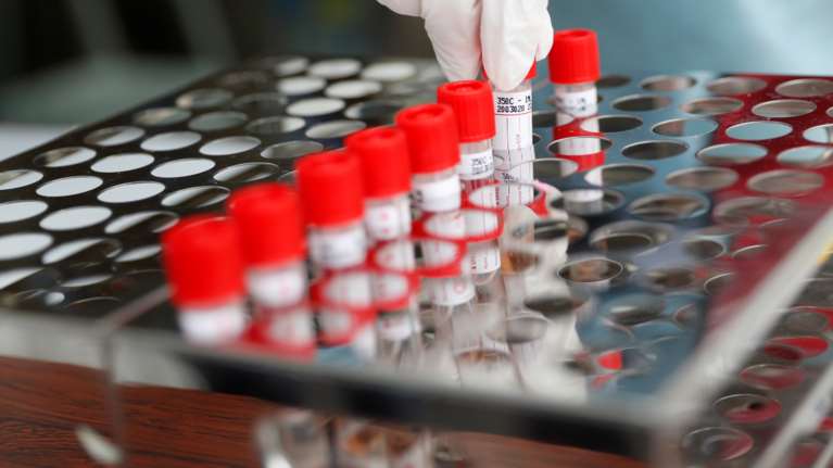 Γ. Ιωαννίδης - Γ. Χρούσος: Οι Έλληνες ερευνητές με την μεγαλύτερη επιστημονική επιρροή