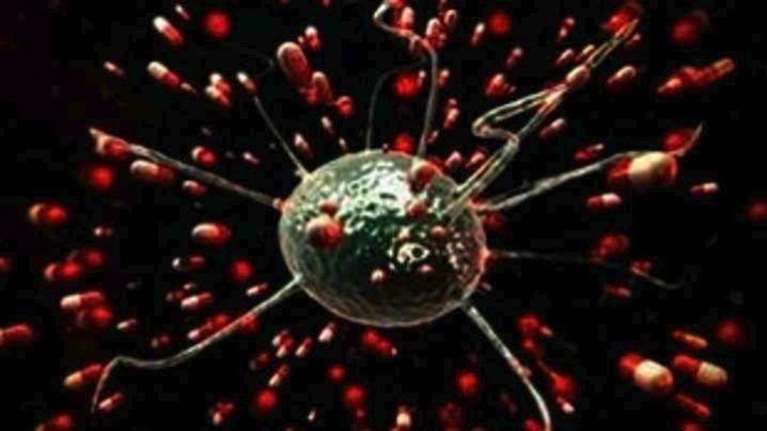 Στοματικά μικρόβια συνδέονται με αυξημένο κίνδυνο καρκίνου του παγκρέατος