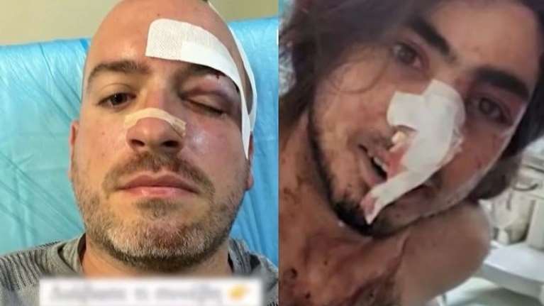 Πάρνηθα: Στη φυλακή οι πέντε κατηγορούμενοι για την άγρια επίθεση στους εθελοντές