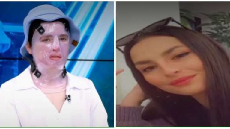 Αντριέλα: &quot;Με κοιτάνε και κάνουν τον σταυρό τους&quot; - Καθηλώνει η 22χρονη που τυλίχθηκε στις φλόγες όταν άναψε τη σόμπα