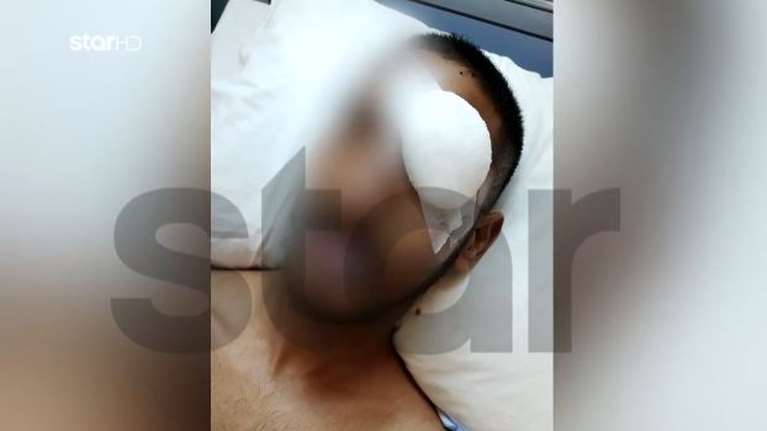 Ραφήνα: Νεαρός καταγγέλλει ότι έχασε το μάτι του  - Σήκωσε την καραμπίνα και άρχισε να πυροβολεί αδιακρίτως, μέσα στο σκοτάδι