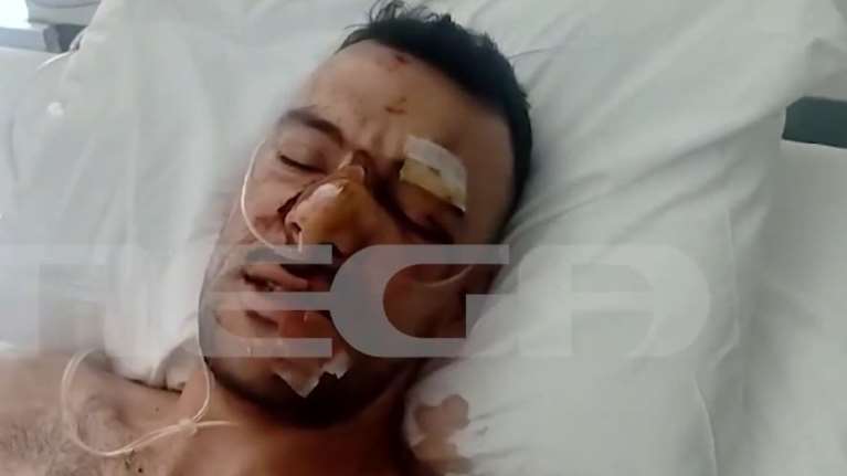 Λέσβος: Αυτός είναι ο ο 35χρονος που δέχθηκε 18 μαχαιριές σε πανηγύρι -  &quot;Ήταν αποφασισμένος να σκοτώσει&quot;