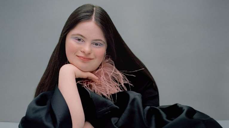 Έλι Γκολντστάιν: Γράφει ιστορία το πρώτο μοντέλο με σύνδρομο Down