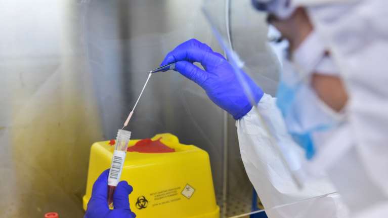 Κορονοϊός - Νέα μελέτη: Οι άνθρωποι με αυτή την ομάδα αίματος κινδυνεύουν περισσότερο να κολλήσουν τον ιό