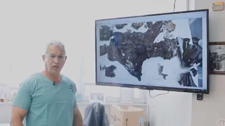 Ισραήλ: Ιατροδικαστές περιγράφουν την απόλυτη φρίκη που έζησαν τα θύματα της Χαμάς- Αγκαλιάστηκαν καθώς τους έκαιγαν ζωντανούς