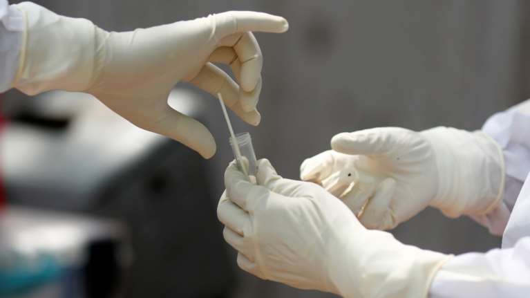 Νέα μελέτη για κορονοϊό: Όσοι νόσησαν έχουν αντισώματα - Τι είπε ο Τσιόδρας