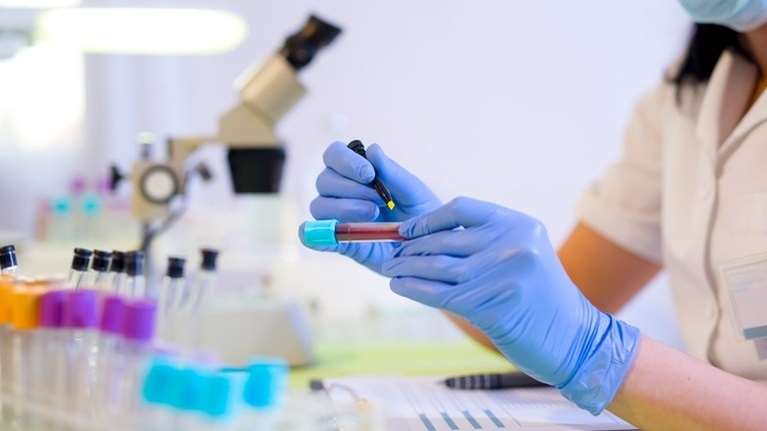 Πώς ένα τεστ αίματος εντοπίζει τα συμπτώματα του Πάρκινσον έως και 7 χρόνια πριν εμφανιστούν