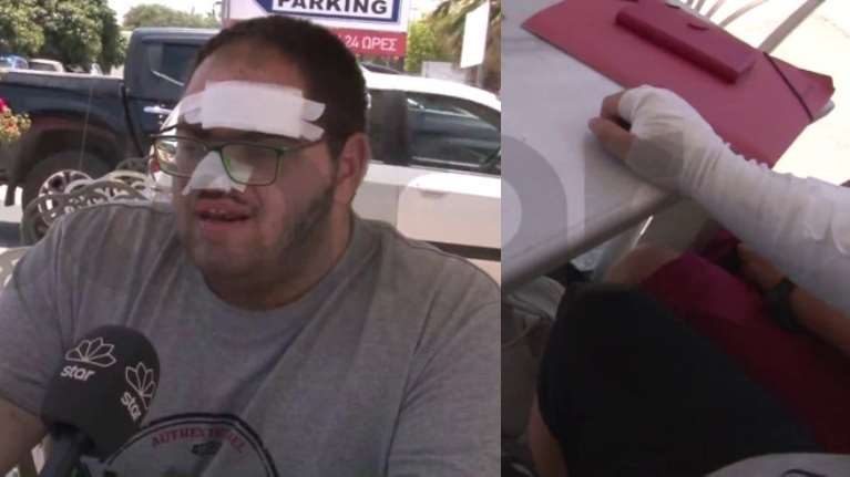 Αδιανόητο περιστατικό στην Κρήτη: Ανασφάλιστος μάγειρας έπαθε εγκαύματα β΄ βαθμού και τον έβαλαν σε δωμάτιο με κρέατα