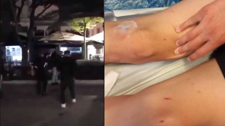 Καλαμάτα: Ξυλοδαρμός - σοκ 16χρονων από συμμορία ανηλίκων - &quot;Εκδίκηση για ένα κορίτσι&quot;