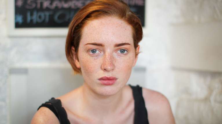 Έτσι θα προλάβεις τα σημάδια της φωτογήρανσης