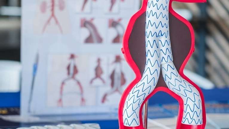 Aνεύρυσμα κοιλιακής αορτής: Οι παράγοντες κινδύνου - Υπάρχουν συμπτώματα;