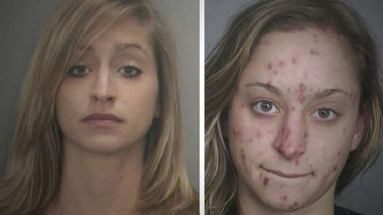 Σκληρές φωτογραφίες: Πως τα ναρκωτικά προκαλούν πρόωρη γήρανση