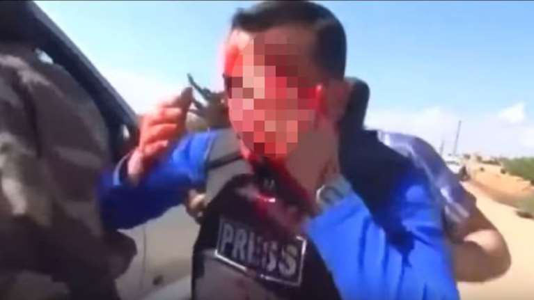 Θραύσματα χτυπούν δημοσιογράφο σε ζωντανή σύνδεση: σκληρό βίντεο