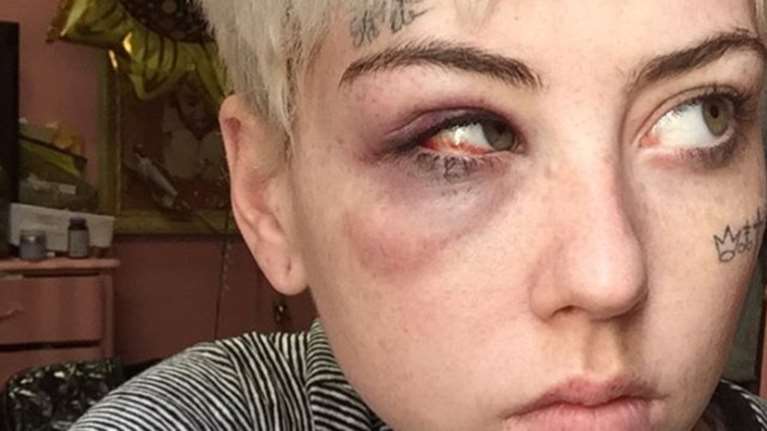 Επίθεση στη ζωγράφο που σκιτσάρισε το πέος του Τραμπ