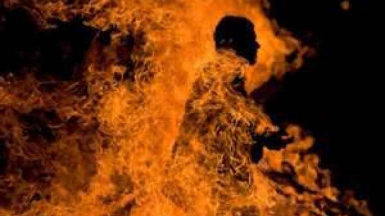 Εκαψε ζωντανή τη 16χρονη κόρη της γιατί παντρεύτηκε τον αγαπημένο της