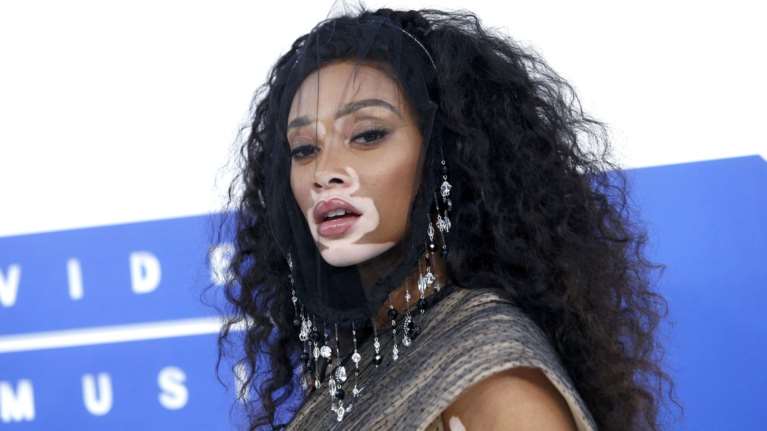 Γιατί η Γουίνι Χάρλοου «κέρδισε» το βραβείο του μοντέλου της χρονιάς