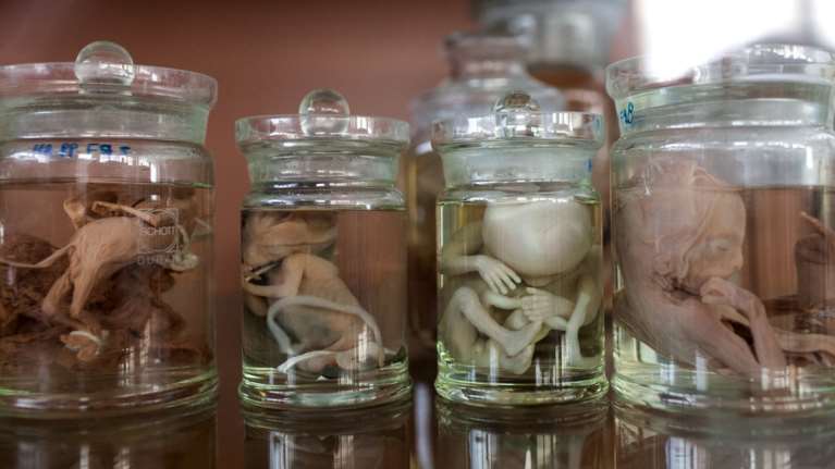 Πέταξε στα σκουπίδια 12 έμβρυα μέσα σε γυάλες