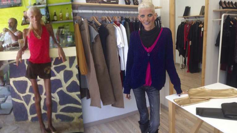 Η Νανά Καραγιάννη τότε και σήμερα:Η μεταμόρφωση &amp; ο γολγοθάς της ανορεξίας