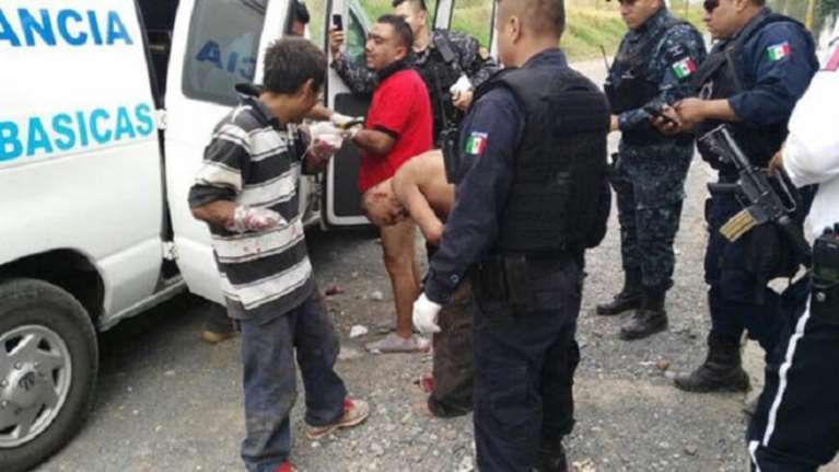 Συμμορία στο Μεξικό έκοψε τα χέρια σε κλέφτες ως προειδοποίηση