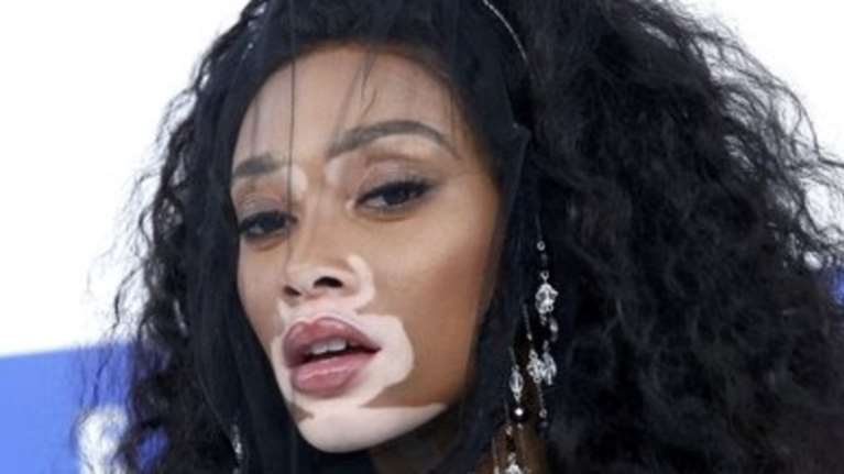 Ένα μοντέλο διαφορετικό από τα άλλα που συγκλονίζει