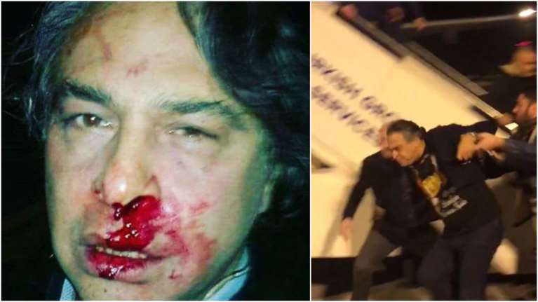 Τουρκία: Συνέλαβαν τον σχεδιαστή μόδας που μίλησε για την Κύπρο